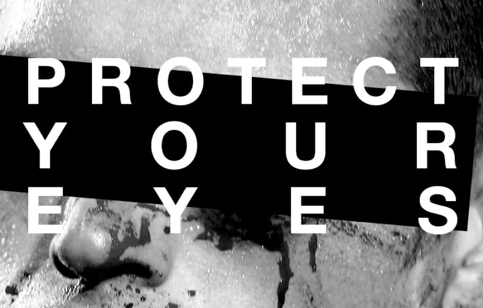 Глазные травмы