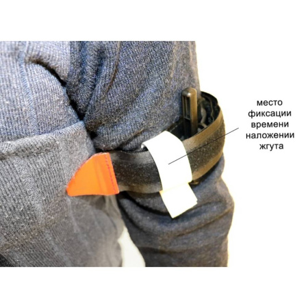 Кровоостанавливающий жгут Медплант ЖК-01 (Вид сложения-1)